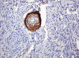 Immunohistochemical analysis of paraffin embedded Human endometrium tissue labelling PARVB with ab140384 at 1/150 dilution.