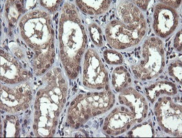 Immunohistochemical analysis of paraffin-embedded Human kidney tissue labelling Parvin alpha with ab140960 at 1/150 dilution.