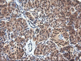 Immunohistochemical analysis of paraffin-embedded Human pancreas tissue labelling Parvin alpha with ab140960 at 1/150 dilution.