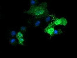 Immunofluorescent analysis of COS7 cells transiently transfected by pCMV6-ENTRY Parvin alpha labelling Parvin alpha with ab134965 at 1/100 dilution.