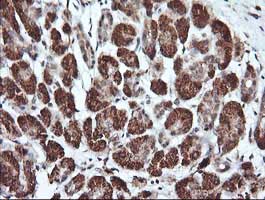 Immunohistochemical analysis of paraffin-embedded Human pancreas tissue labelling Parvin alpha with ab140502 at 1/150 dilution.