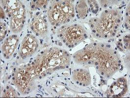 Immunohistochemical analysis of Paraffin-embedded Human Kidney tissue labelling Parvin alpha with ab139287 at 1/150 dilution.