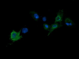 Immunofluorescence analysis of COS7 cells transiently transfected by pCMV6-ENTRY Parvin alpha labelling Parvin alpha with ab139287 at 1/100 dilution.