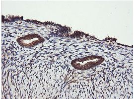 Immunohistochemical analysis of paraffin embedded Human endometrium tissue labelling Parvin alpha with ab156777 at 1/150 dilution.
