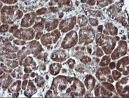 Immunohistochemical analysis of paraffin-embedded Human pancreas tissue labeling Parvin alpha with ab156797 at 1/150 dilution.