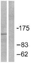 All lanes : Anti-Patched / PTCH1 antibody (ab53715) at 1/500 dilutionLane 1 : Extracts from mouse muscle cells, minus immunising peptideLane 2 : Extracts from mouse muscle cells, plus immunising peptide