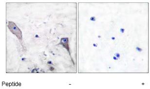 ab53715, at a 1/50 dilution, staining Patched / PTCH in paraffin embedded human brain tissue by Immunohistochemsitry in the absence (left image) or presence (right image) of the immunising peptide.ab53715, at a 1/50 dilution, staining Patched / PTCH in paraffin embedded human brain tissue by Immunohistochemsitry in the absence (left image) or presence (right image) of the immunising peptide.