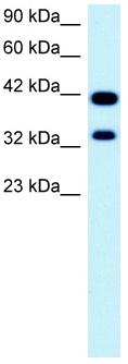 Anti-Pax2 antibody - ChIP Grade (ab23799) at 2.5 µg/ml + Fetal kidney lysate
