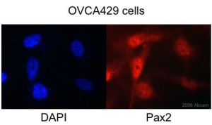 The human ovarian carcinoma cell line OVCA429 was used with ab23799 in ICC/IF. The cells were fixed in paraformaldehyde. Blocking was in 5% serum for 1 hour. The primary antibody was incubated at a dilution of 1/250 for one hour. Immunofluorescence (ICC/IF) only worked with 3% paraformaldehyde/2% sucrose fixation. When 70% methanol/30% acetone fixation was tried non-specific cytoplasmic staining was seen. In the left hand panel staining with DAPI is shown, and in the right staining with the ab23799 antibody.