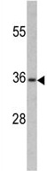 Anti-PAX4 antibody (ab135598) at 1/50 dilution + CEM cell lysate at 35 µg