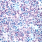 ab15164 staining PAX5 in human tonsil by Immunohistochemistry (FFPE-sections).
