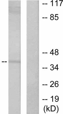 All lanes : Anti-PAX5 antibody (ab53046) at 1/500 dilutionLane 1 : 293 cell extractLane 2 : 293 cell extract with immunising peptide