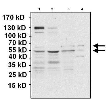 All lanes : Anti-PAX7 antibody (ab187339) at 1/1000 dilutionLane 1 : HeLa whole cell lysateLane 2 : MCF7 whole cell lysateLane 3 : HSkMSC whole cell lysateLane 4 : SJCRH30 whole cell lysateLysates/proteins at 50 µg per lane.SecondaryGoat anti-rabbit HRP at 1/20000 dilutiondeveloped using the ECL technique