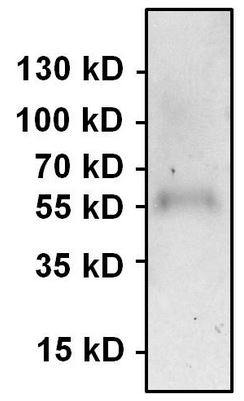 Immunoprecipitation of PAX7 was performed using HeLa whole cell lysate. Antigen-antibody complexes were formed by incubating 500µg of lysate with 3µg of ab187339 overnight on a rocking platform at 4°C. The immune complexes were captured on 50ul Protein A/G Agarose, washed extensively, and eluted. Samples was resolved on a 4-20% Tris-HCl polyacrylamide gel, transferred to a PVDF membrane, and blocked with 5% BSA/TBS-0.1%Tween-20 for 1 hour. The membrane was probed with ab187339 at 1/1000 dilution overnight rotating at 4°C.