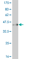 Anti-PAX7 antibody (ab77180) at 5 µg/ml + immunogen at 0.2 µgSecondaryGoat Anti-Mouse IgG (H&L)-HRP Conjugate at 1/5000 dilution