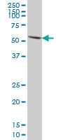 Anti-PAX7 antibody (ab77180) at 5 µg/ml + Hela cell lysate at 25 µgSecondaryGoat Anti-Mouse IgG (H&L)-HRP Conjugate at 1/2500 dilution