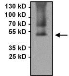 Detection of PAX8 in Immunoprecipitates of COS7 whole cell lysates. Antigen-antibody complexes were formed by incubating 500μg of lysate with 3μg of ab183578. The membrane was probed with ab183578 at 1/1000 dilution.