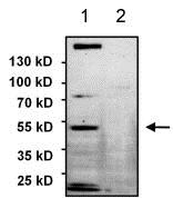All lanes : Anti-PAX8 antibody (ab183578) at 1/1000 dilutionLane 1 : SKOV3 whole cell lysateLane 2 : HeLa whole cell lysateLysates/proteins at 75 µg per lane.SecondaryGoat anti-rabbit HRP at 1/500 dilutiondeveloped using the ECL technique
