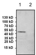 All lanes : Anti-PAX8 antibody (ab183578) at 1/1000 dilutionLane 1 : COS7 whole cell lysateLane 2 : HeLa whole cell lysateLysates/proteins at 60 µg per lane.SecondaryGoat anti-rabbit HRP at 1/500 dilutiondeveloped using the ECL technique