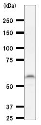 Anti-PAX8 antibody [PAX8R1] (ab53490) at 1/100 dilution + F2408 whole cell lysate at 25 µgSecondaryMouse IgG antibody at 1/2500 dilution