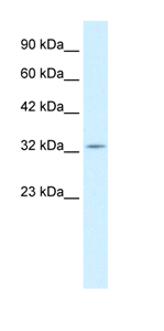 Anti-PAX9 antibody (ab42506) at 1 µg/ml + Jurkat cell lysateSecondaryHRP conjugated anti-Rabbit IgG at 1/50000 dilution