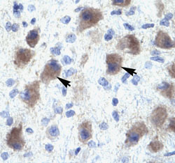 ab42506 at 4.0µg/ml staining PAX 9 in human brain tissue.