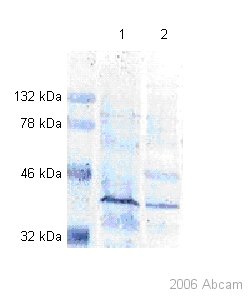 All lanes : Anti-PAX9 antibody [7C2] (ab28538)Lane 1 : mouse oesophageal protein extractLane 2 : human oesophageal protein extract