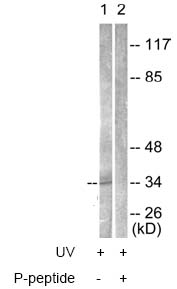 All lanes : Anti-PBK (phospho T9) antibody (ab63363) at 1/500 dilutionLane 1 : K562 cells, treated with UV (30mins); without the phosphopeptideLane 2 : K562 cells, treated with UV (30mins); with the phosphopeptide (5 µg)Lysates/proteins at 5 µg per lane.
