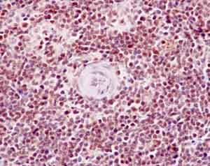 Immunohistochemical analysis of paraffin-embedded Rat spleen tissue labeling PBK (phospho T9) with ab184953 at 1/100 dilution followed by prediluted HRP Polymer for Rabbit IgG. Counter stained with Hematoxylin