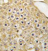 Immunohistochemical analysis of formalin-fixed, paraffin-embedded Human testis tissue labeling PBK with ab190075 at 10µg/ml followed by peroxidase-conjugated secondary antibody and DAB staining.
