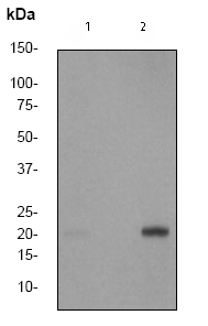 All lanes : Anti-PBP (phospho S153) antibody [EP2845Y] (ab75971) at 1/2000 dilutionLane 1 : HeLa cell lysates un-treatedLane 2 : HeLa cell lysates treated with calyculin ALysates/proteins at 10 µg per lane.SecondaryHRP labelled goat anti-rabbit at 1/2000 dilution