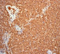 ab75971, at 1/100 dilution, staining PBP in human liver by immunohistochemistry using paraffin-embedded tissue.