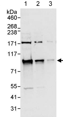 All lanes : Anti-PBXIP1 antibody - N-terminal (ab176591) at 0.04 µg/mlLane 1 : HeLa whole cell lysate at 50 µgLane 2 : HeLa whole cell lysate at 15 µgLane 3 : HeLa whole cell lysate at 5 µgdeveloped using the ECL technique