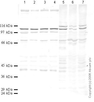 All lanes : Anti-PC1/3 antibody - Aminoterminal end (ab28551) at 1/1000 dilutionLane 1 : SF treated Hs1.Tes LysateLane 2 : TPA Hs1.Tes LysateLane 3 : IL1-beta Hs1.Tes LysateLane 4 : TNF-alpha Hs1.Tes LysateLane 5 : SF treated ST LysateLane 6 : TPA treated SF LysateLane 7 : IL1-beta ST LysateLysates/proteins at 10 µl per lane.
