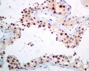 Immunohistochemical analysis of paraffin-embedded Human testis tissue labelling PCBD2 with ab133688 at 1/100 dilution.