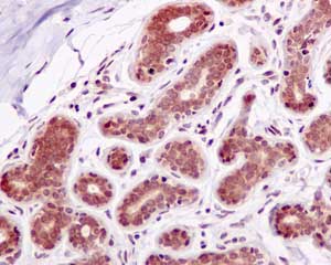Immunohistochemical analysis of paraffin-embedded Human breast tissue labeling NMD3 with ab170898 at 1/50 dilution.