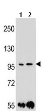 All lanes : Anti-PCDH1 antibody - N-terminal (ab170812) at 1/100 dilutionLane 1 : MDA-MB453 cell line lysatesLane 2 : ZR-75-1 cell line lysatesLysates/proteins at 35 µg per lane.
