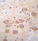 Immunohistochemical analysis of paraffin embedded Human brain tissue labeling PCDH1 with ab170812 at a 1/10 dilution, followed by peroxidase conjugation of the secondary antibody and DAB staining.