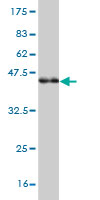 Western blot against tagged recombinant protein immunogen using ab57532 PCDH10 antibody at 1ug/ml.