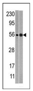 All lanes : Anti-NMD3 antibody - Carboxyterminal end (ab71313) at 1/60 dilutionLane 1 : mouse heart tissue lysates Lane 2 : T47D tissue lysatesLysates/proteins at 35 µg per lane.