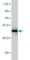 Western blot against tagged recombinant protein immunogen using ab57588 PCDH20 antibody at 1ug/ml.