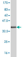 Western blot against tagged recombinant protein immunogen using ab57610 PCDHA1 antibody at 1ug/ml.