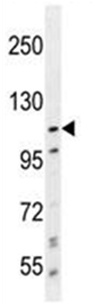Anti-PCDHA8 antibody - C-terminal (ab170788) at 1/100 dilution + ZR-75-1 cell lysate at 35 µg