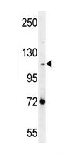 Anti-PCDHAC2 antibody (ab170796) at 1/100 dilution + NCI-H460 cell line lysates at 35 µg