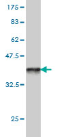 Western blot against tagged recombinant protein immunogen using ab58272 PCDHB14 antibody at 1ug/ml.