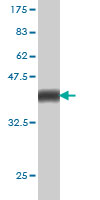 Western blot against tagged recombinant protein immunogen using ab57531 PCDHGA1 antibody at 1ug/ml.