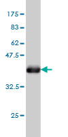Western blot against tagged recombinant protein immunogen using ab57517 PCDHGB2 antibody at 1ug/ml.