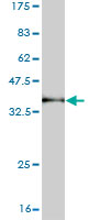Western blot against tagged recombinant protein immunogen using ab57511 PCDHGC5 antibody at 1ug/ml.