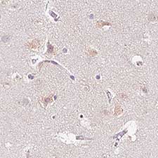Immunohistochemical analysis of Human cerebral cortex tissue labeling PCM1 with ab154142 at 1/200 dilution.