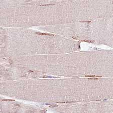 Immunohistochemical analysis of Human dtriated muscle tissue labeling PCM1 with ab154142 at 1/200 dilution.